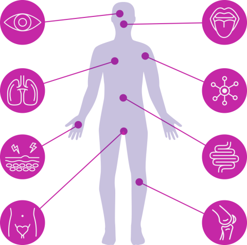 Graphic of a person's body with line drawings of specific areas of the body that chronic GVHD can affect