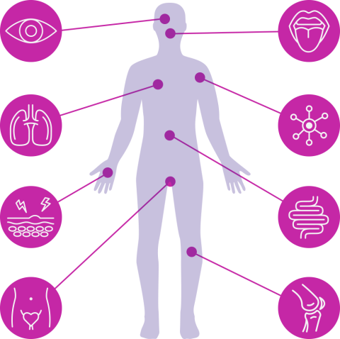 Full body diagram showing common signs and symptoms of chronic GVHD