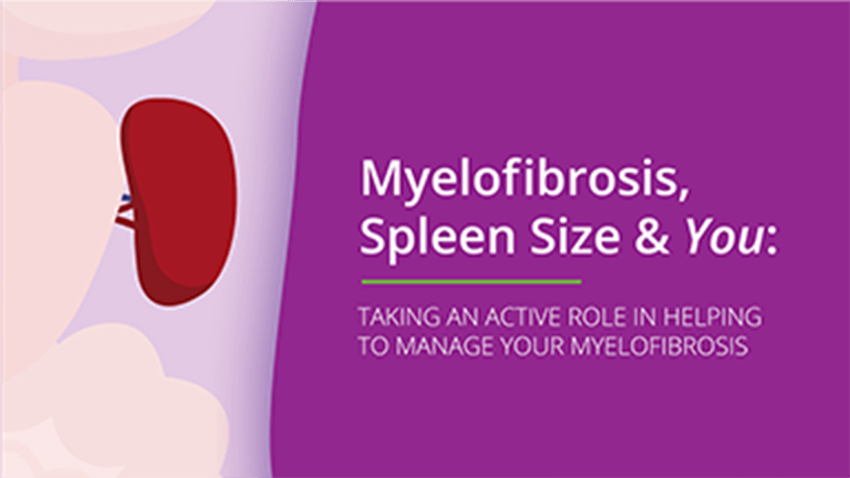 Thumbnail image of Myelofibrosis, Spleen Size & You